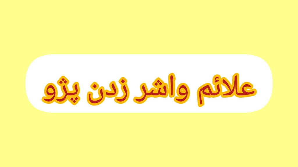 علائم واشر زدن پژو